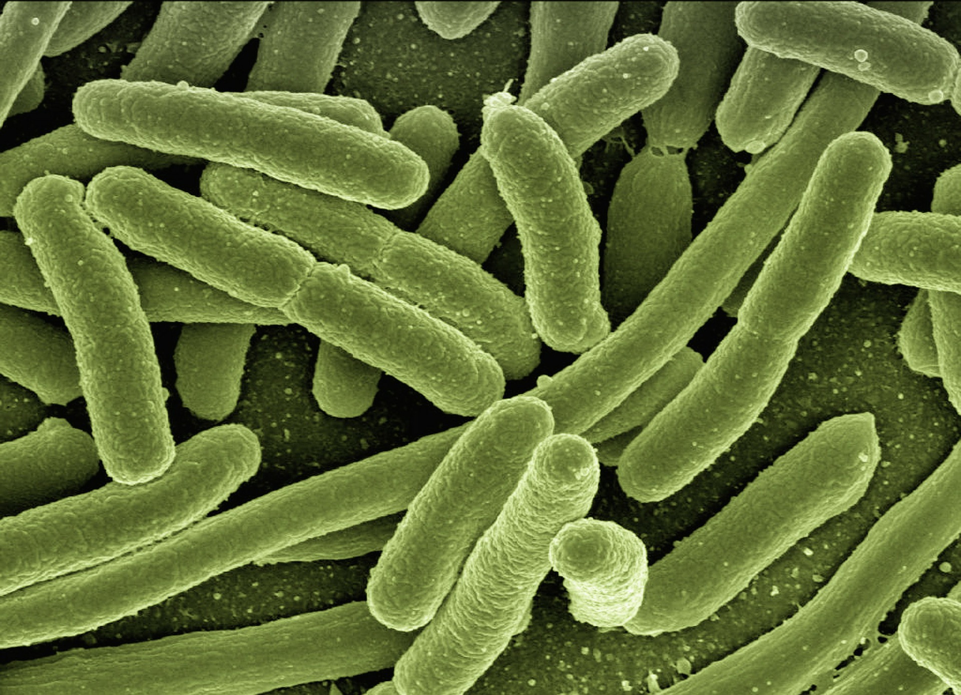 Imagen Control de Legionella